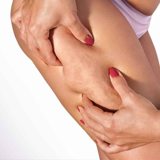 Nouvelles avancées dans la lutte contre le surpoids et la cellulite : des traitements innovants promettent des résultats significatifs