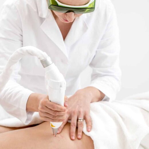 Laser vasculaire