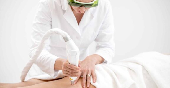 Laser vasculaire