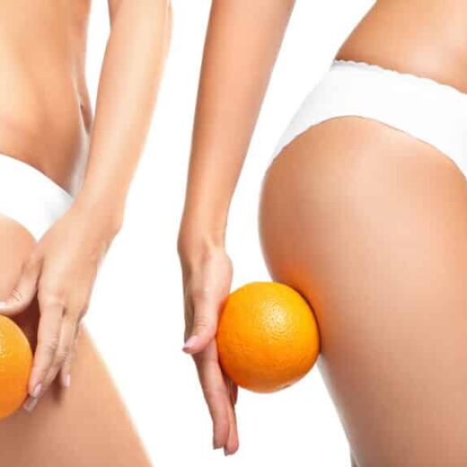 CELLUTION® by DELEO